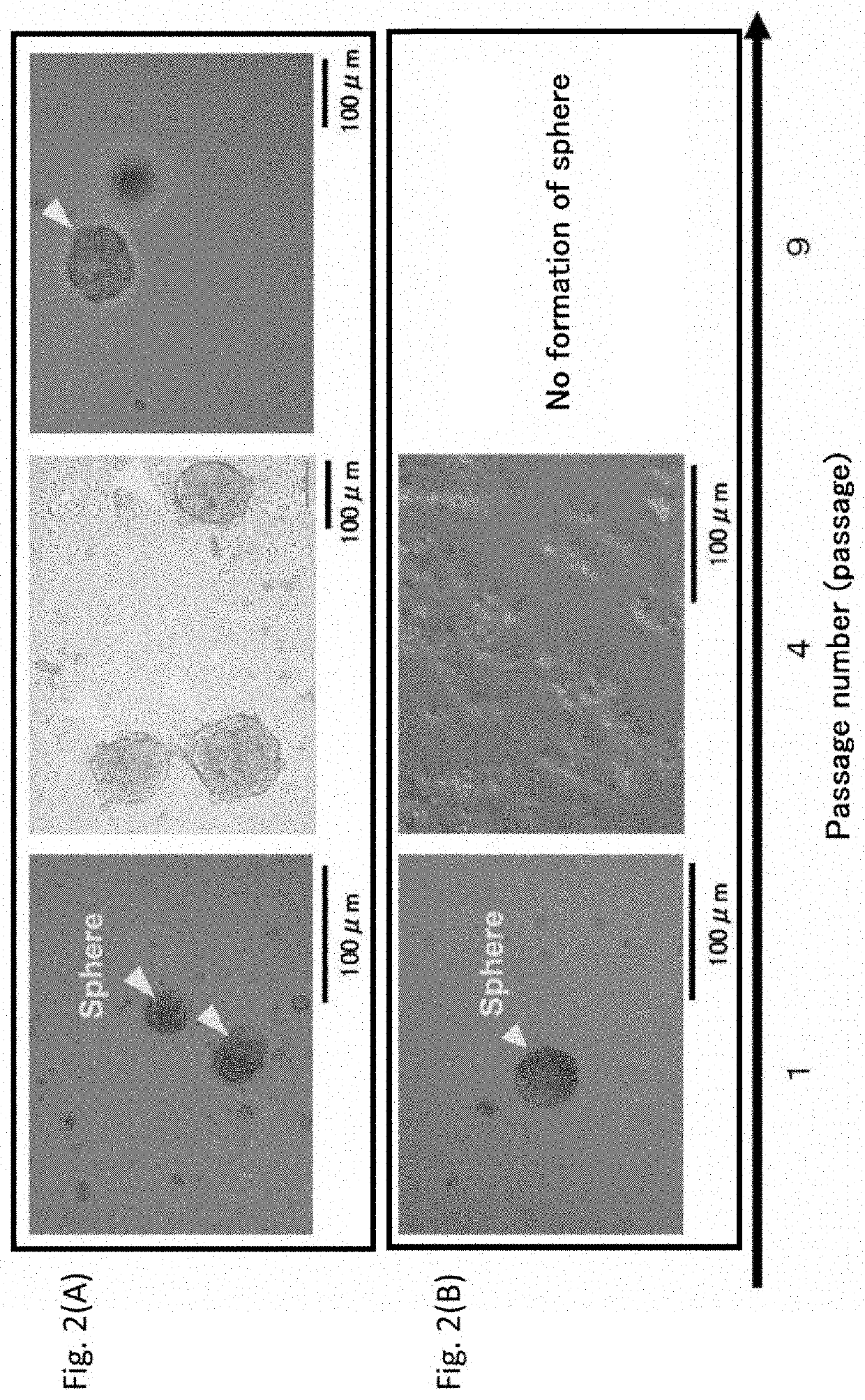 Immortalized sweat gland myoepithelial cell