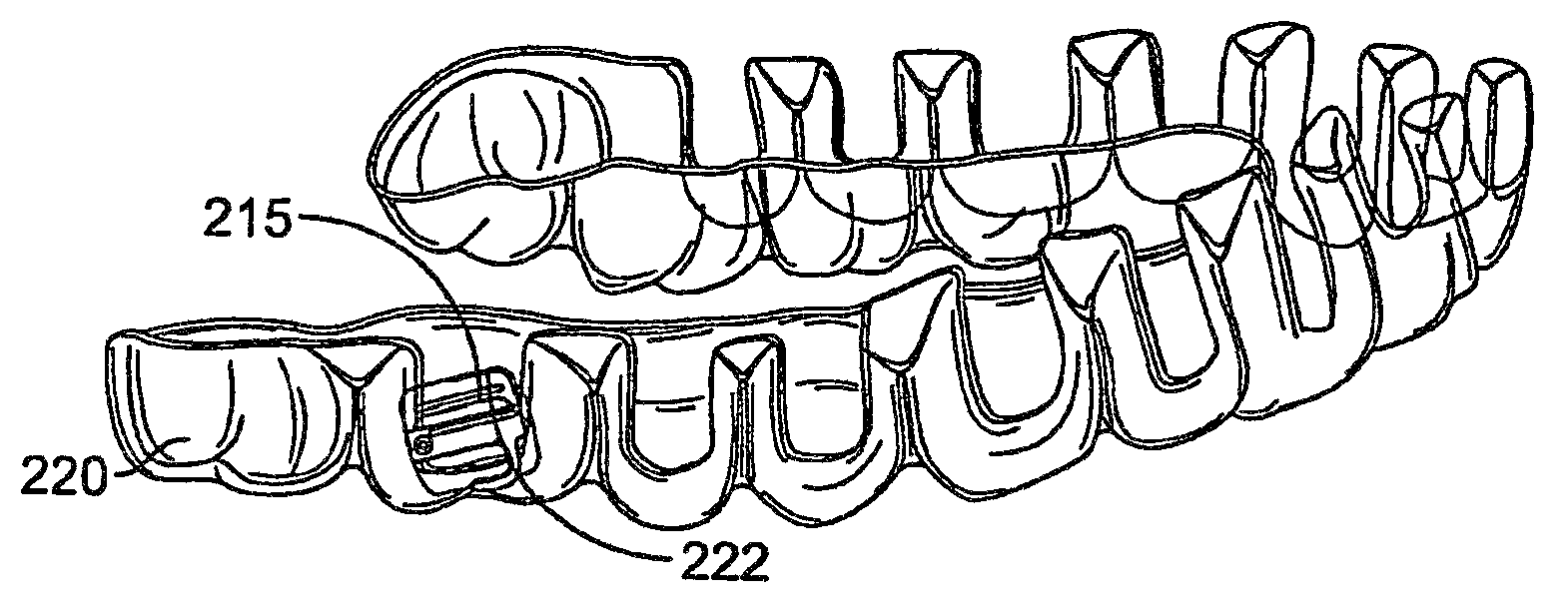 Systems and methods for fabricating a dental template