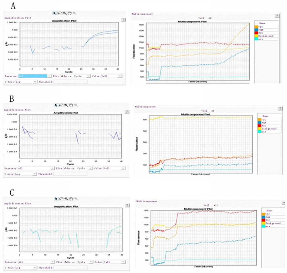 A primer set for detecting p.pro189ala locus genotype and its detection kit and application