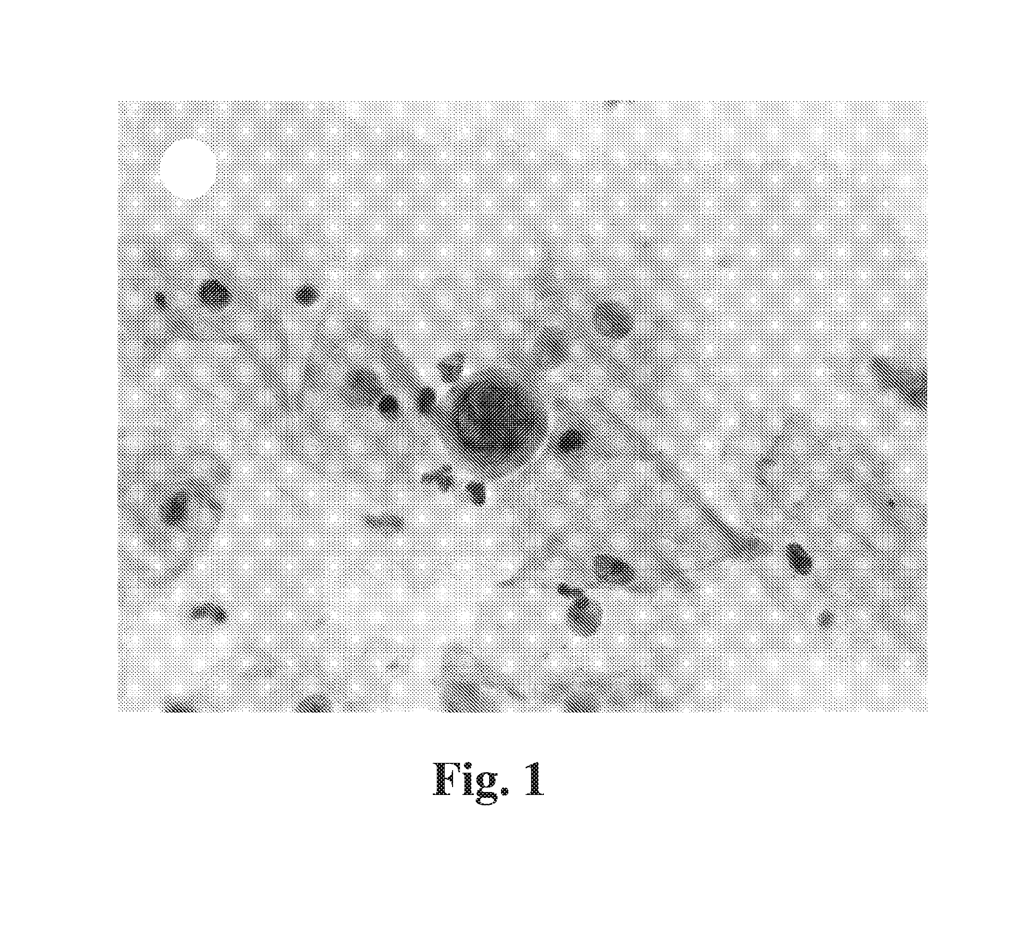 Method for detection of fetal abnormalities