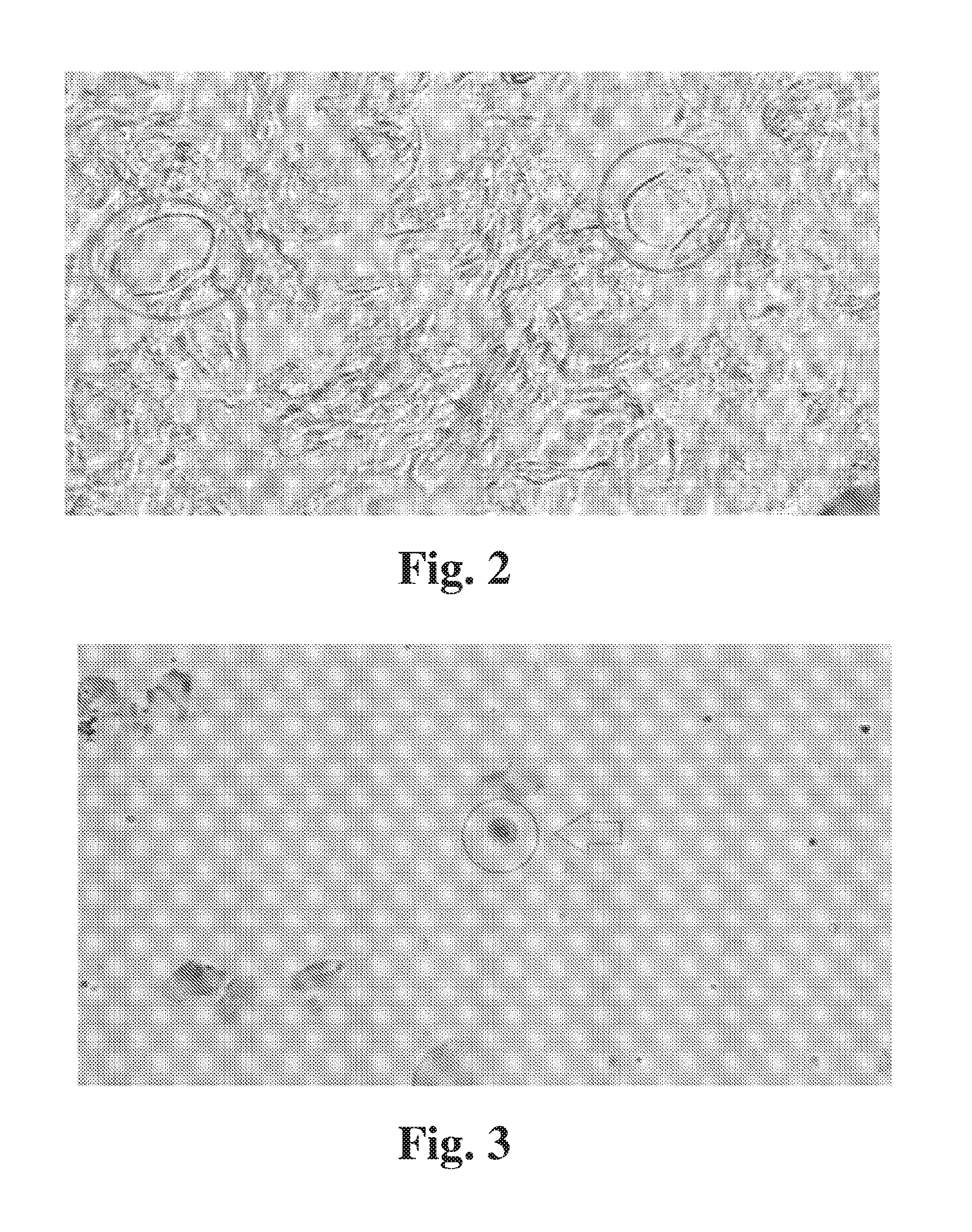 Method for detection of fetal abnormalities