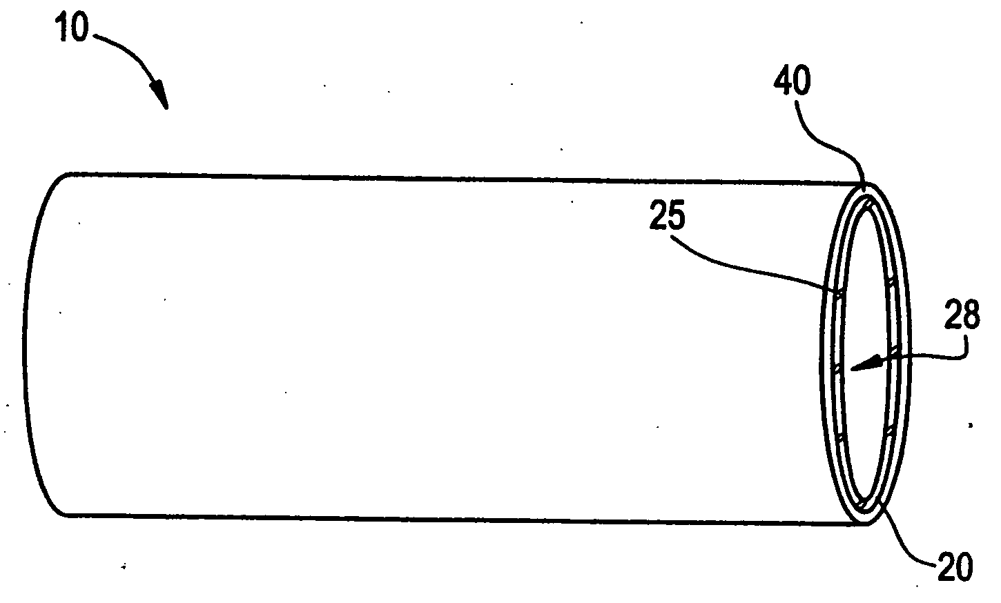 Intraluminal lining