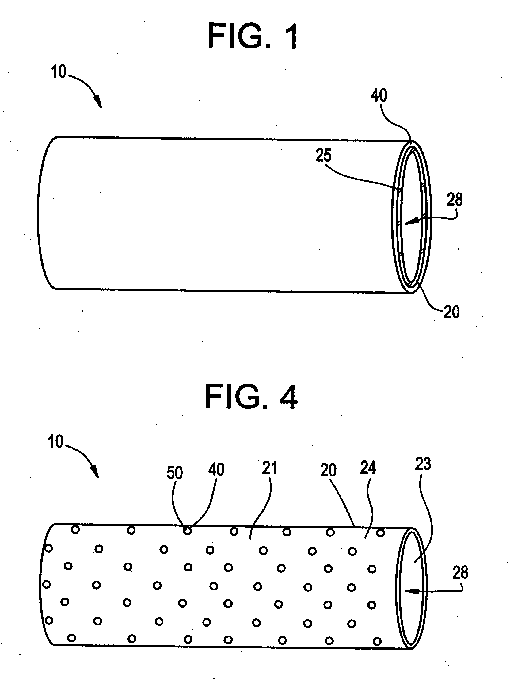 Intraluminal lining