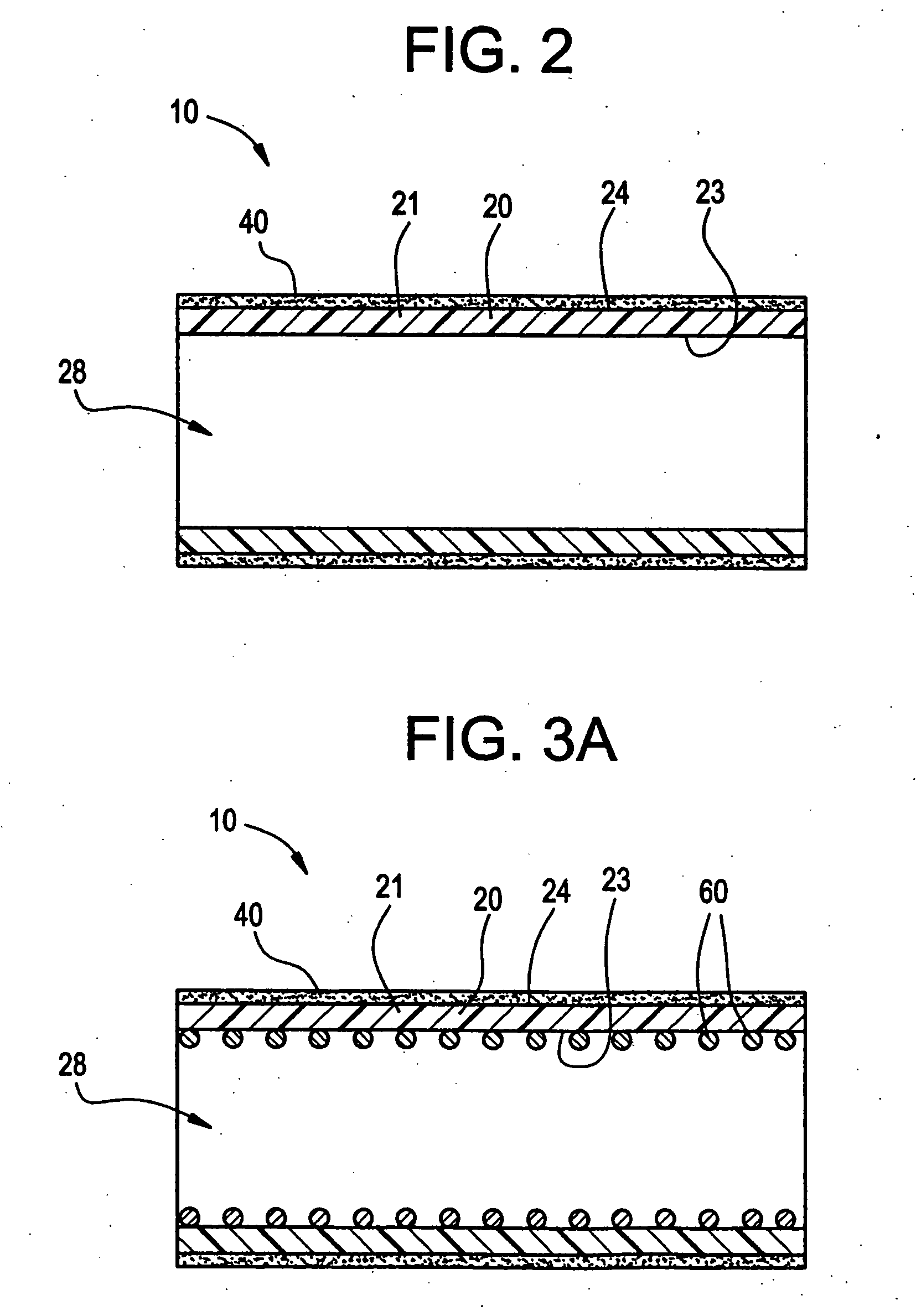 Intraluminal lining