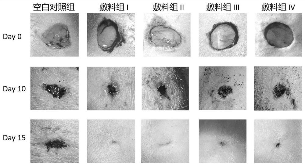 Gelatin-based biocompatible polymer dressing