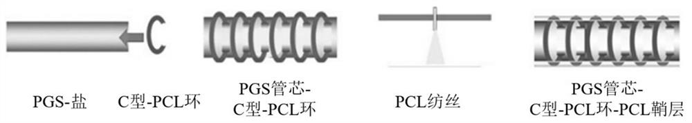 Elastic degradable tracheal stent and its construction method