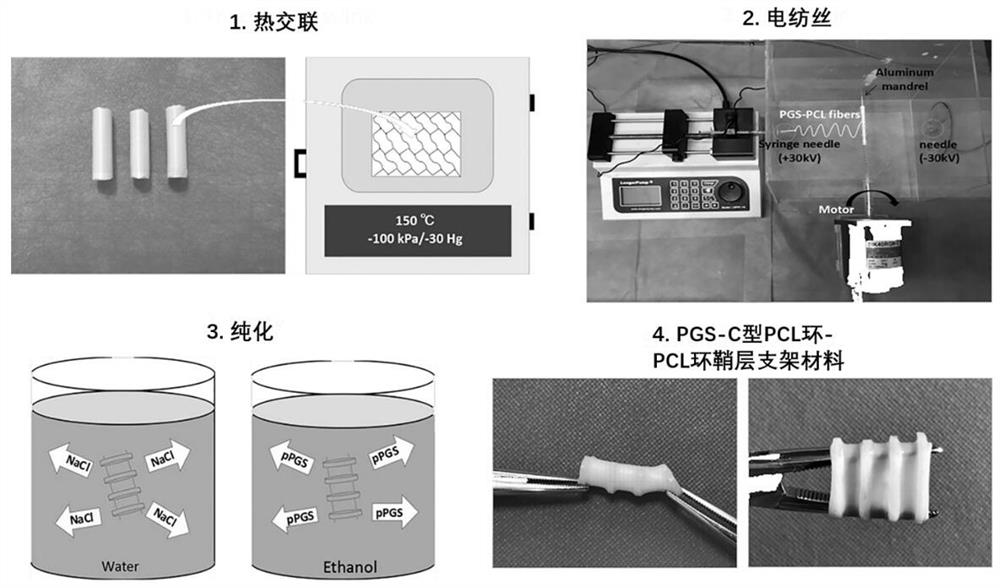 Elastic degradable tracheal stent and its construction method