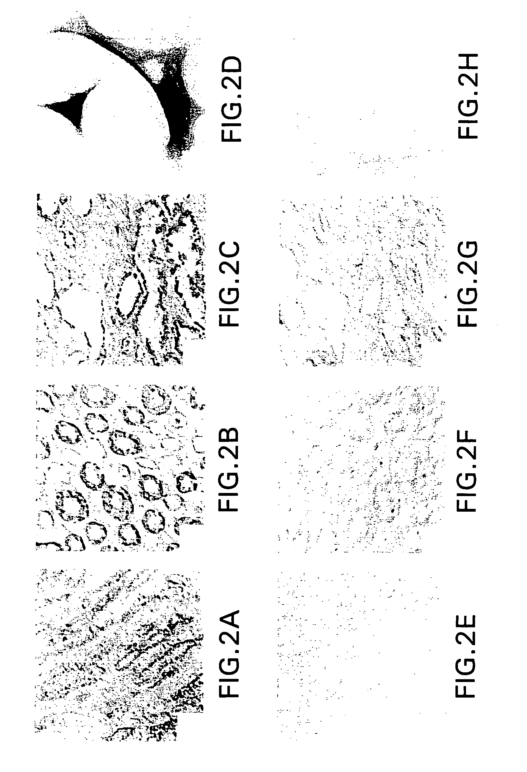 Screening methods for compounds useful in the treatment of polycystic kidney disease