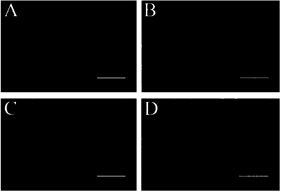 Preparation method of functionalized retinal pigment epithelial cell graft