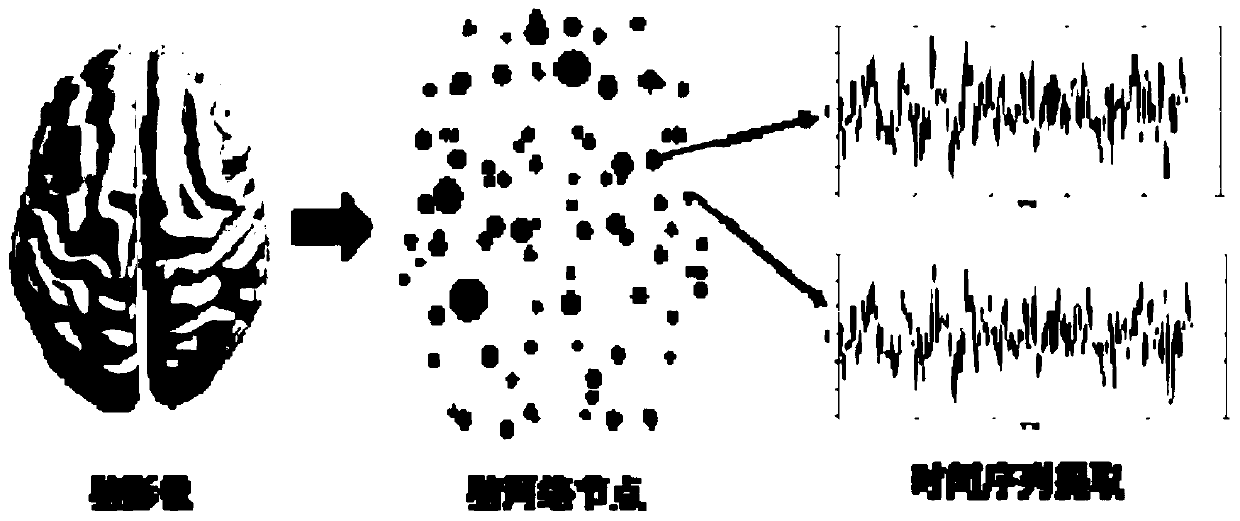 Alzheimer's disease brain network feature extraction method based on a continuous homology technology