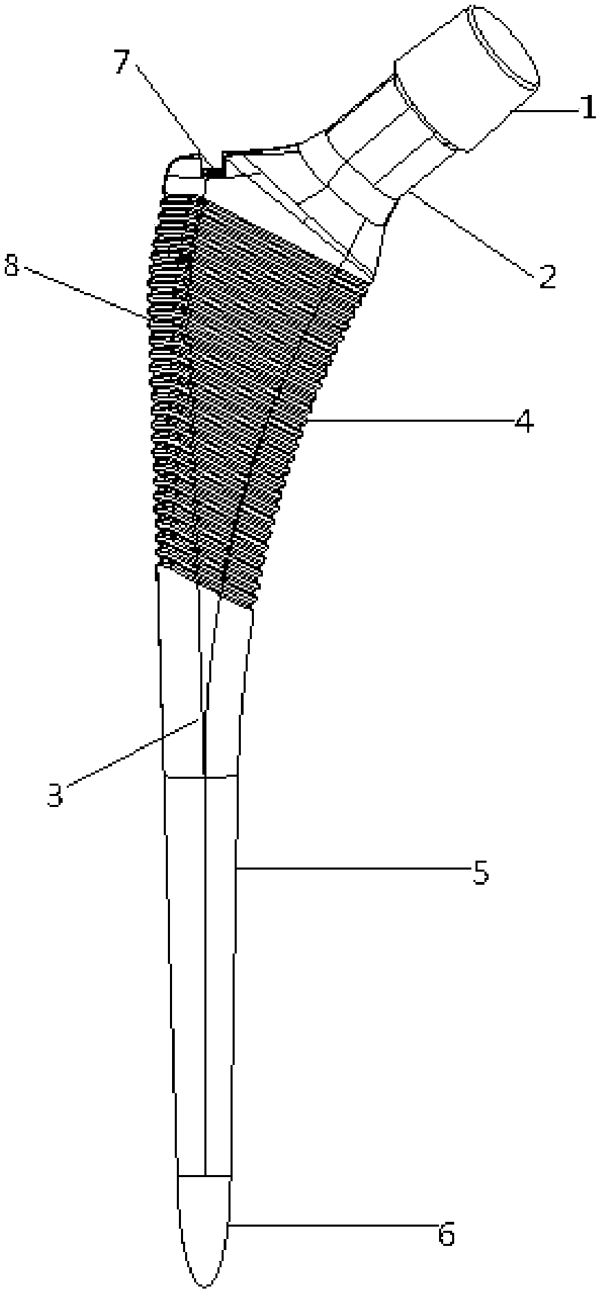 Artificial alpha femoral stem prosthesis