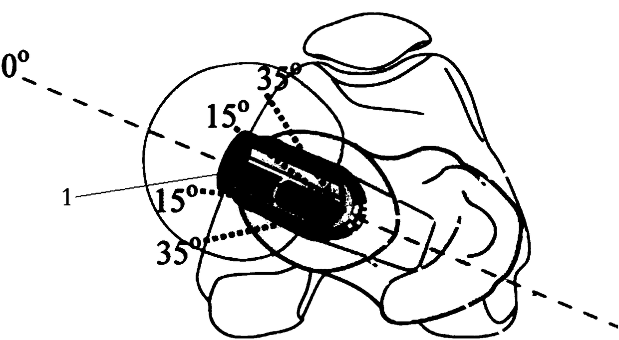 Artificial alpha femoral stem prosthesis