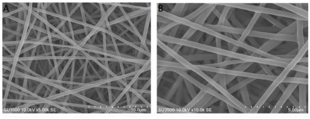 Preparation method of shell-core structure nanofiber membrane containing antibacterial peptide