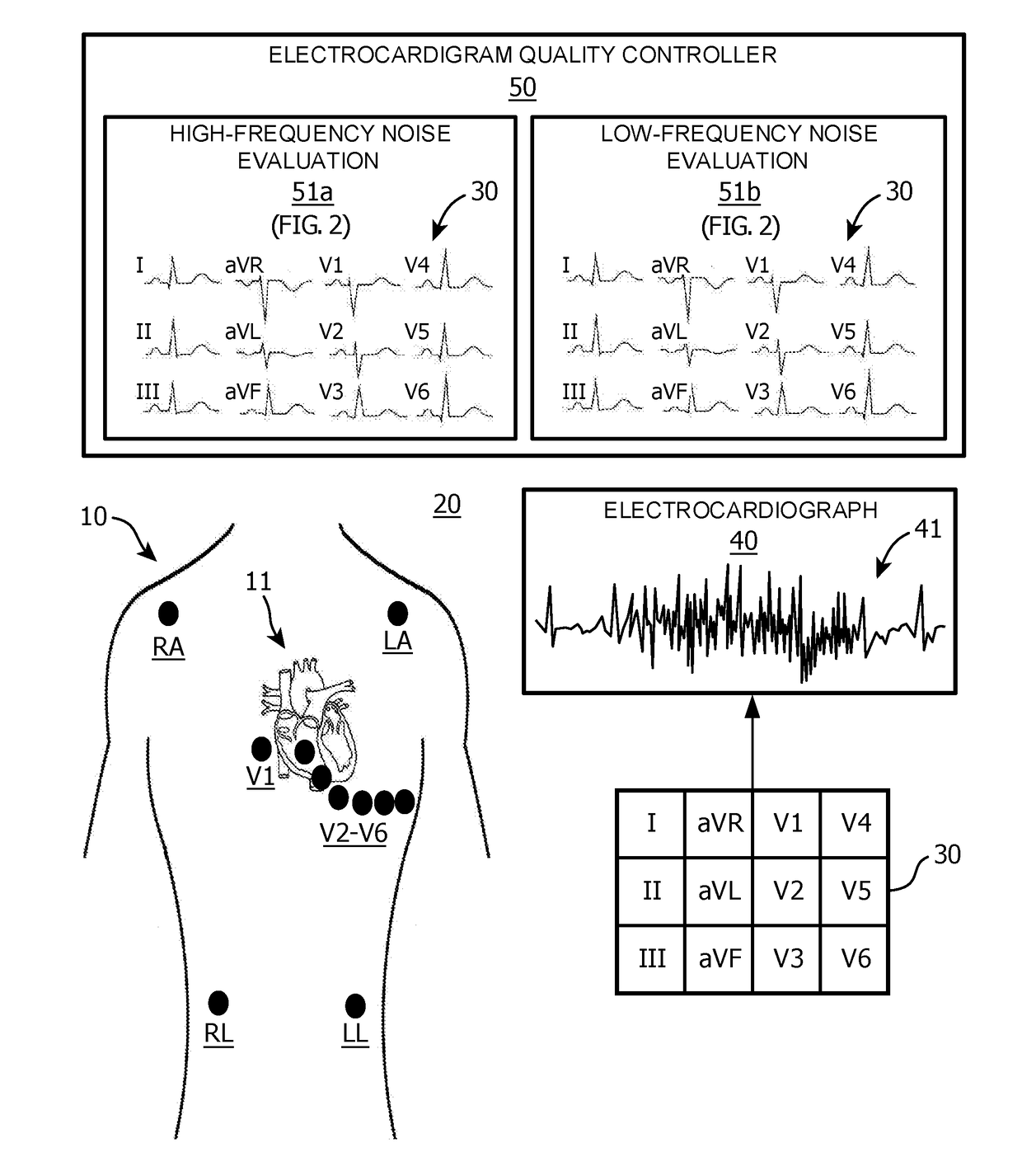 High/low frequency signal quality evaluations of ECG lead signals