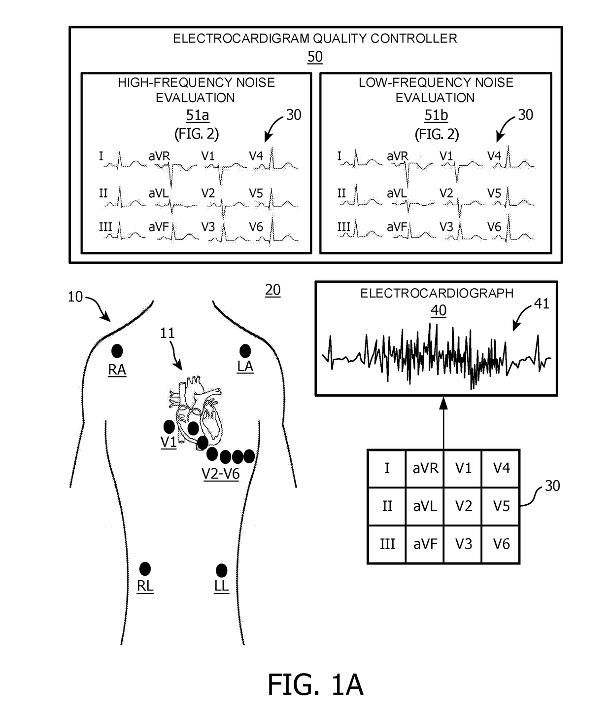 High/low frequency signal quality evaluations of ECG lead signals