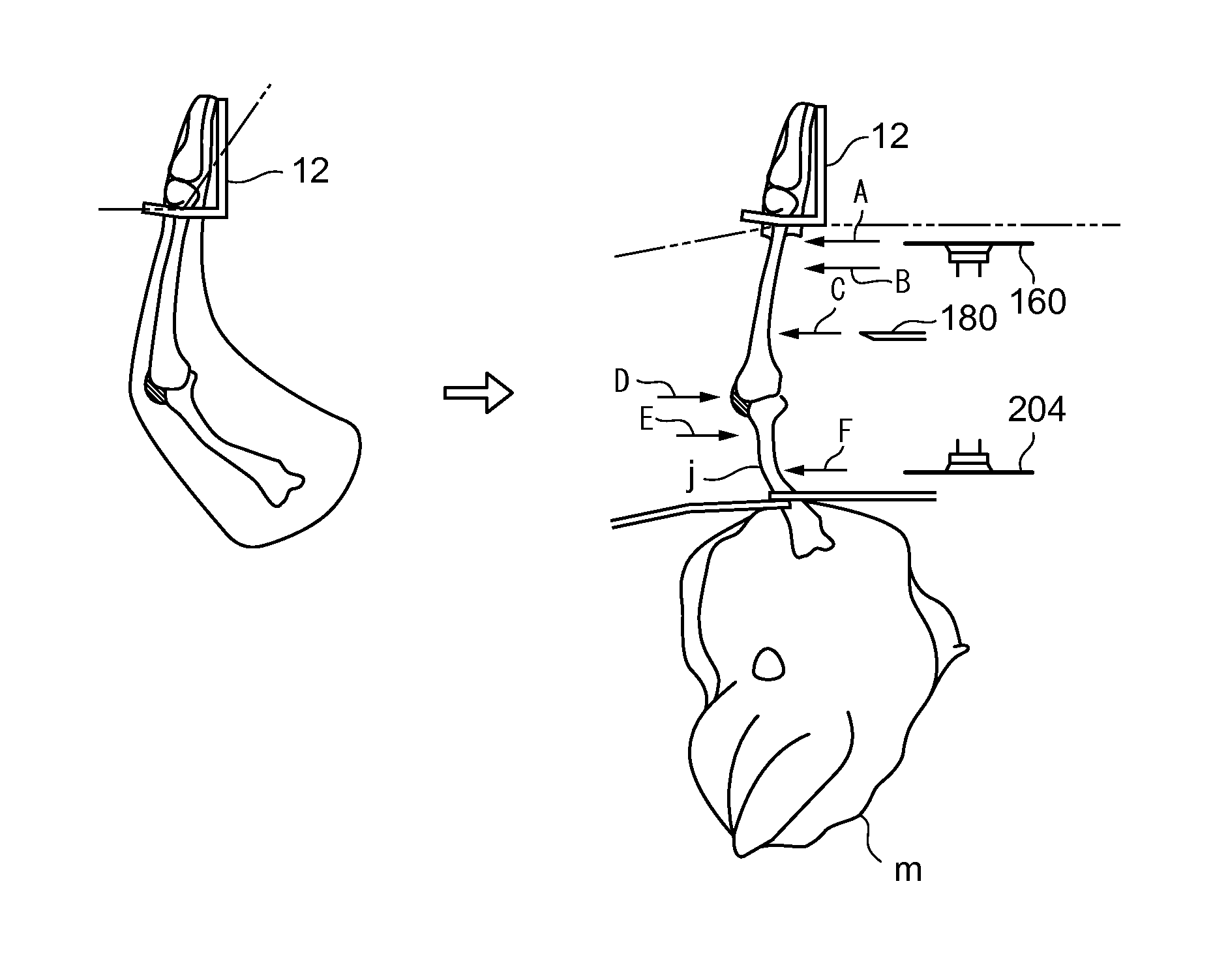 Device and method for deboning bone-in leg