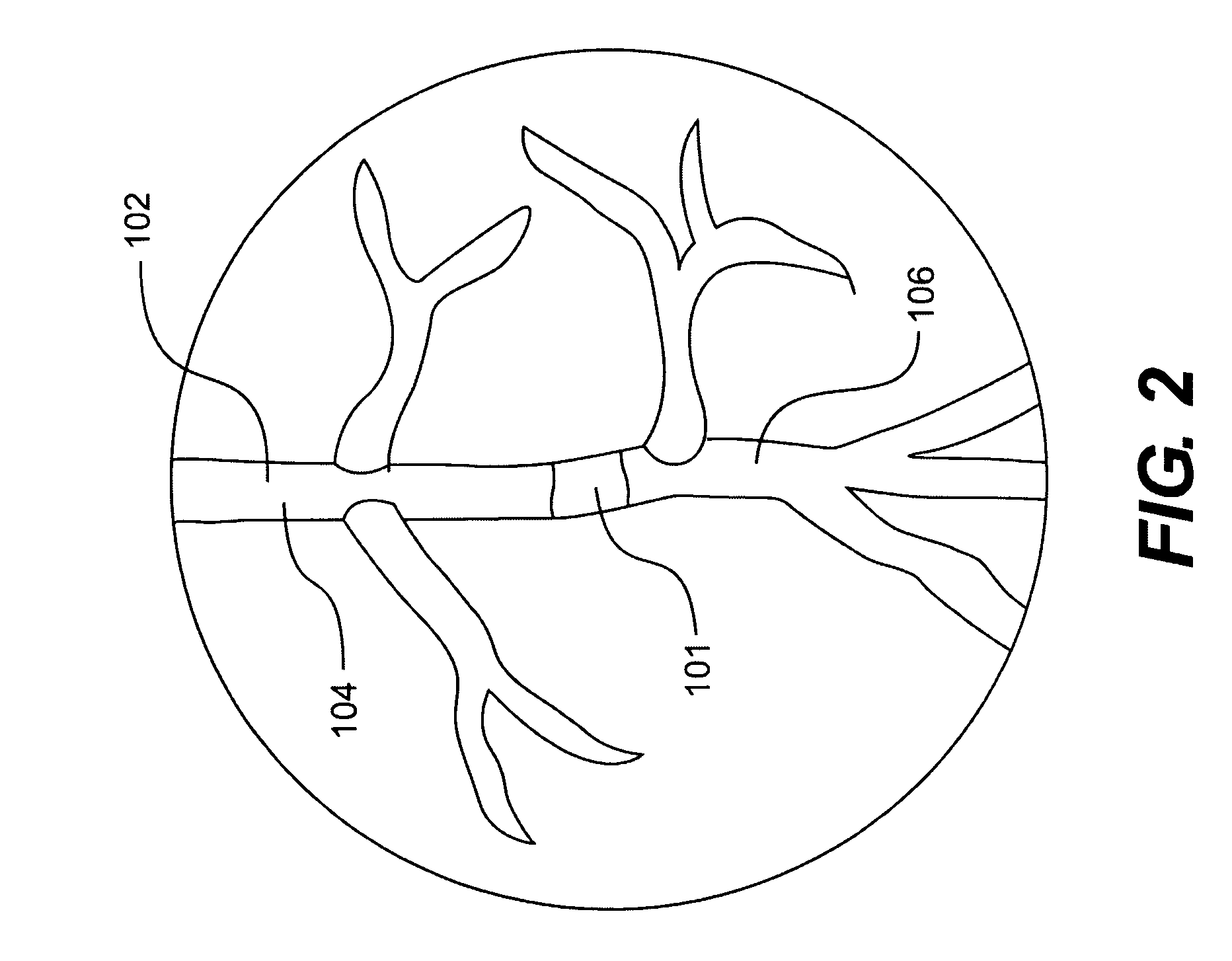 Methods and apparatus for crossing occlusions in blood vessels