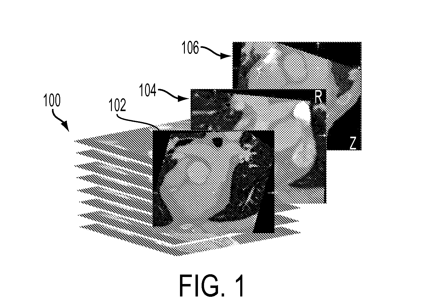 Method and System for Dynamic Pulmonary Trunk Modeling and Intervention Planning