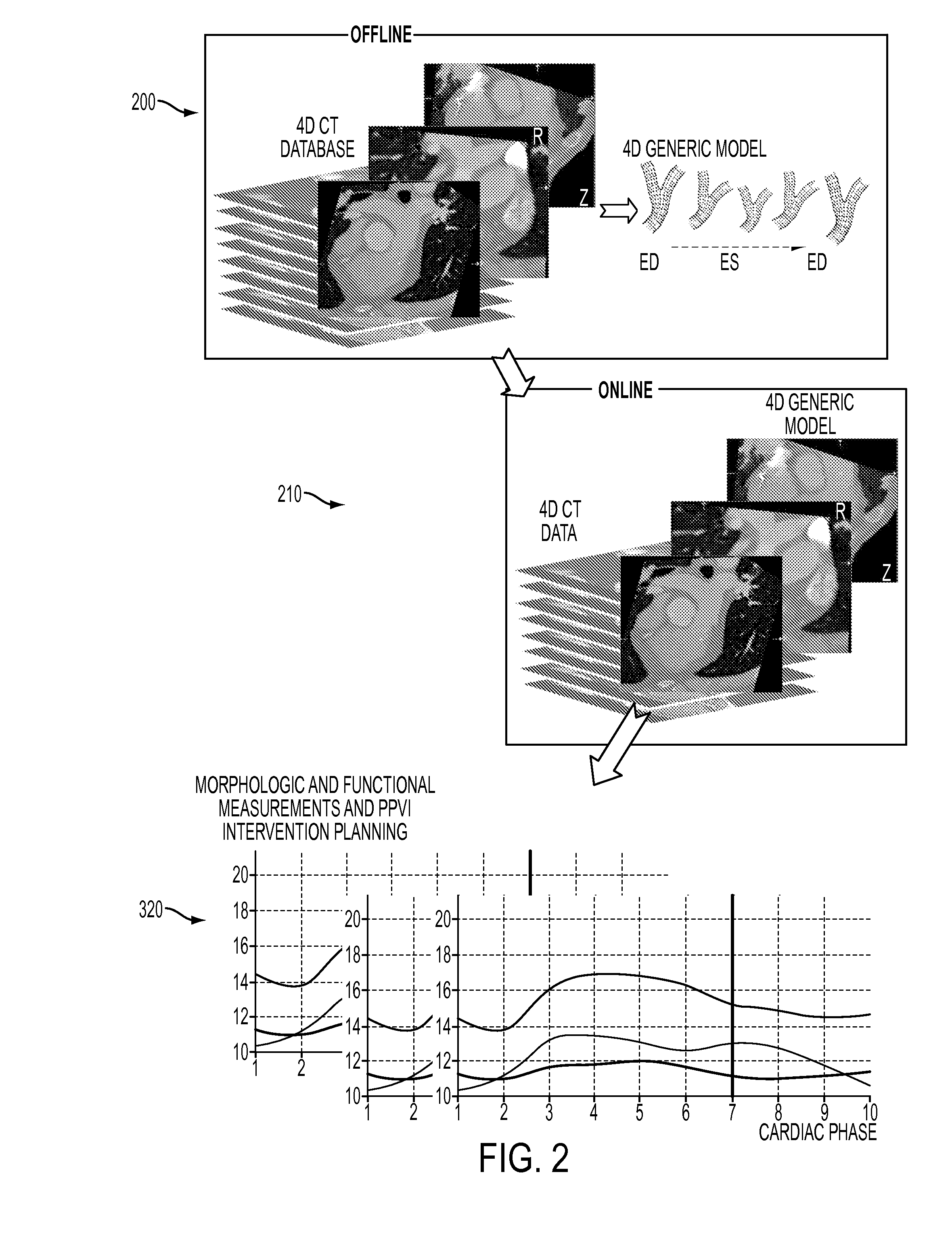 Method and System for Dynamic Pulmonary Trunk Modeling and Intervention Planning