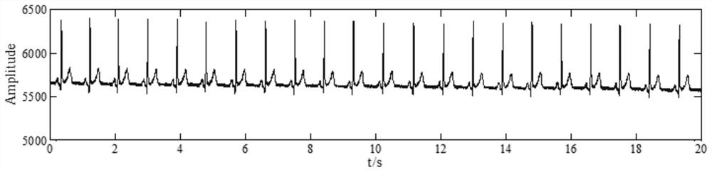 Respiratory rate detection method and device and medical equipment