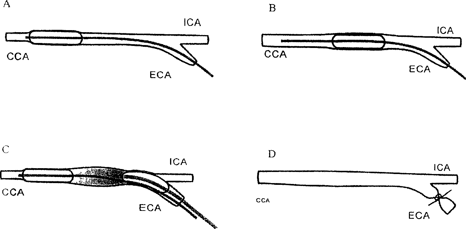 Recombinant adenovirus for expressing human CREG and uses thereof