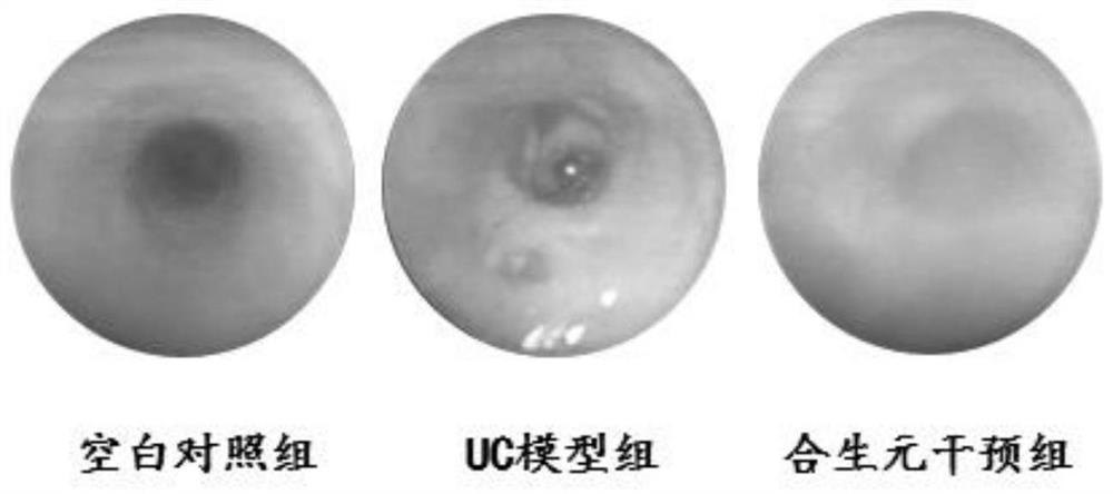 Method for researching effect of microecological preparation on DSS-induced colitis mice