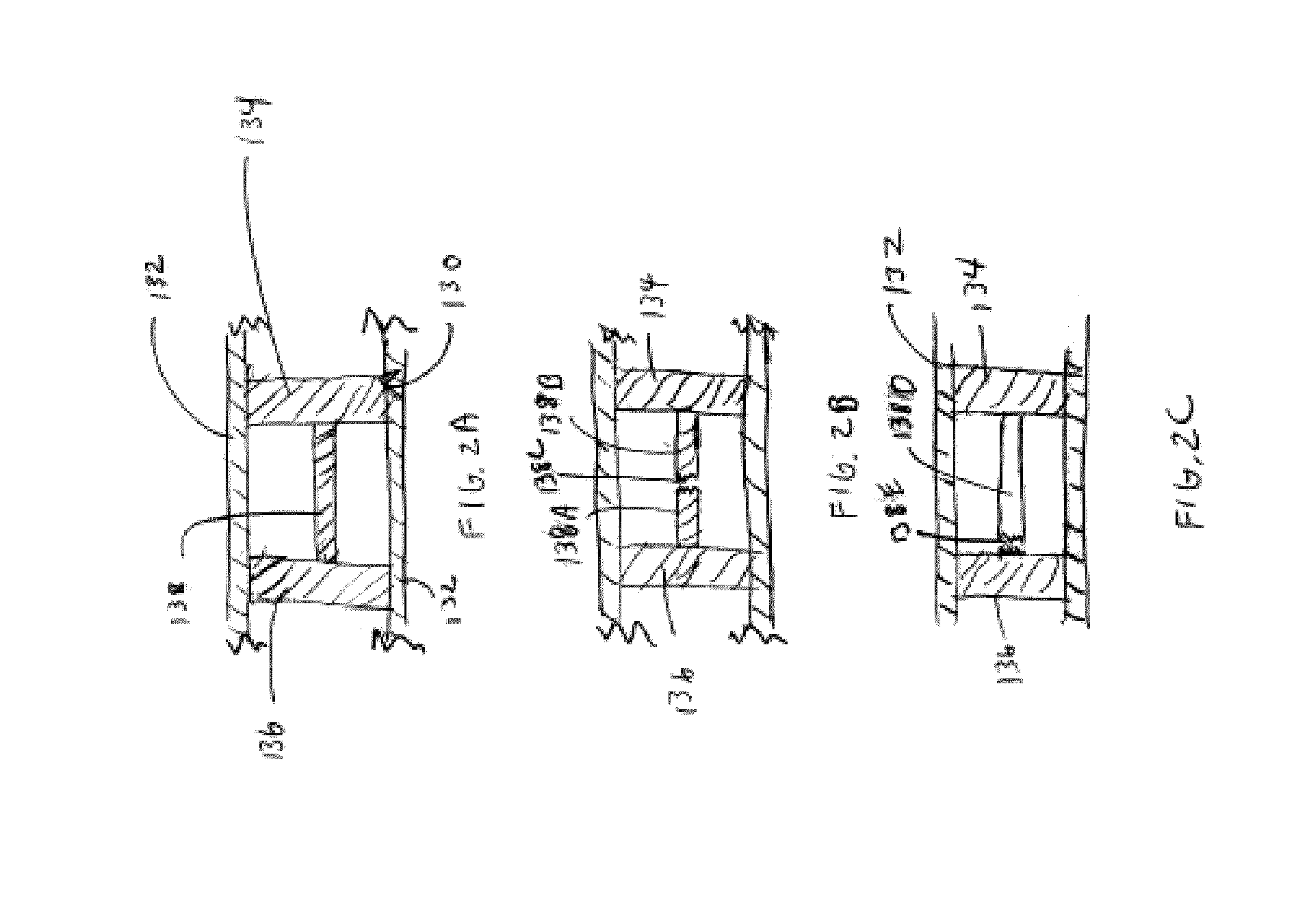 Method of treatment with a bioabsorbable stent with time dependent structure and properties and regio-selective degradation