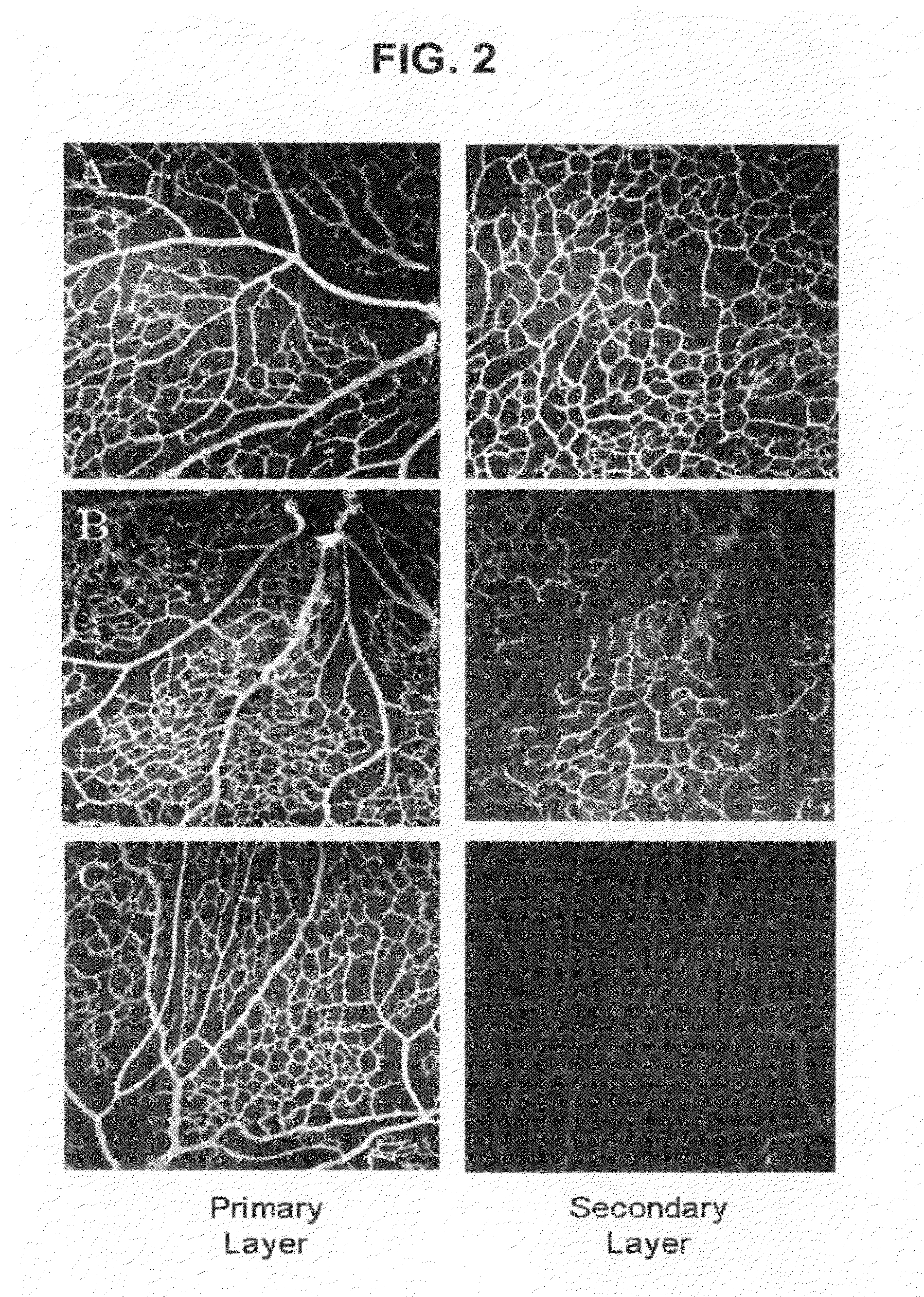 tRNA synthetase fragments