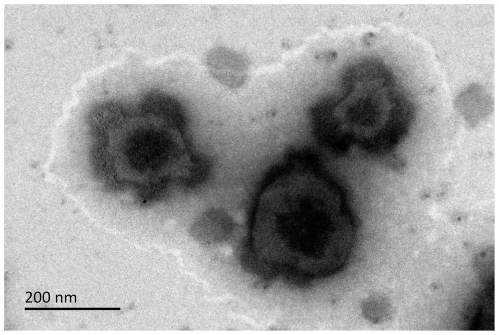 A kind of polyglutamic acid graft metformin stereostructure nano-micelle and preparation method thereof