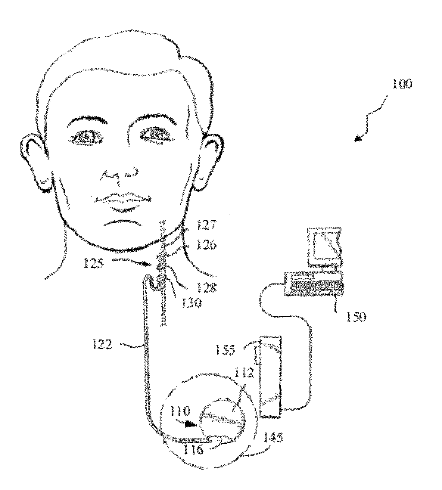 Detecting or validating a detection of a state change from a template of heart rate derivative shape or heart beat wave complex