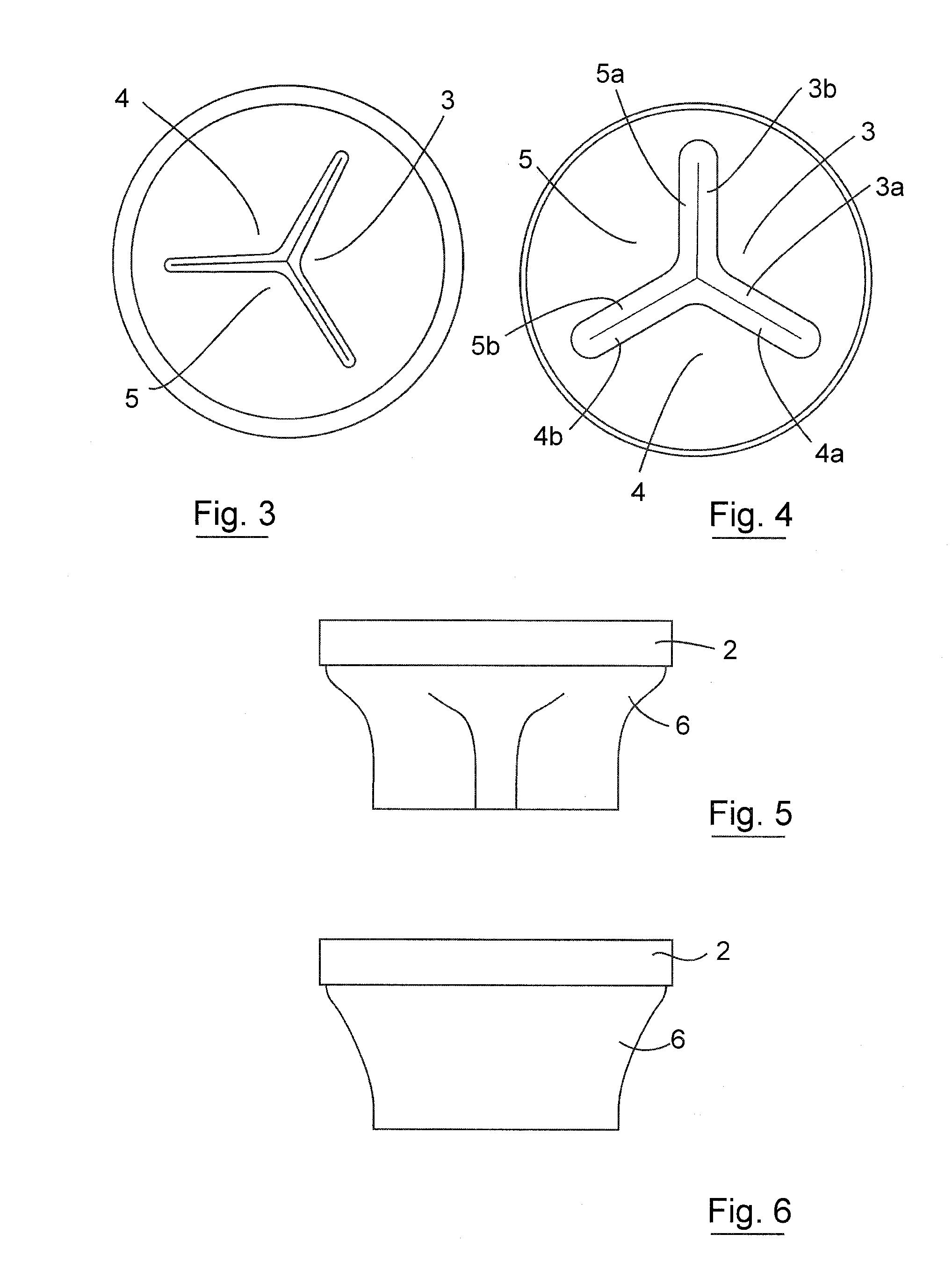 Gastrointestinal implant