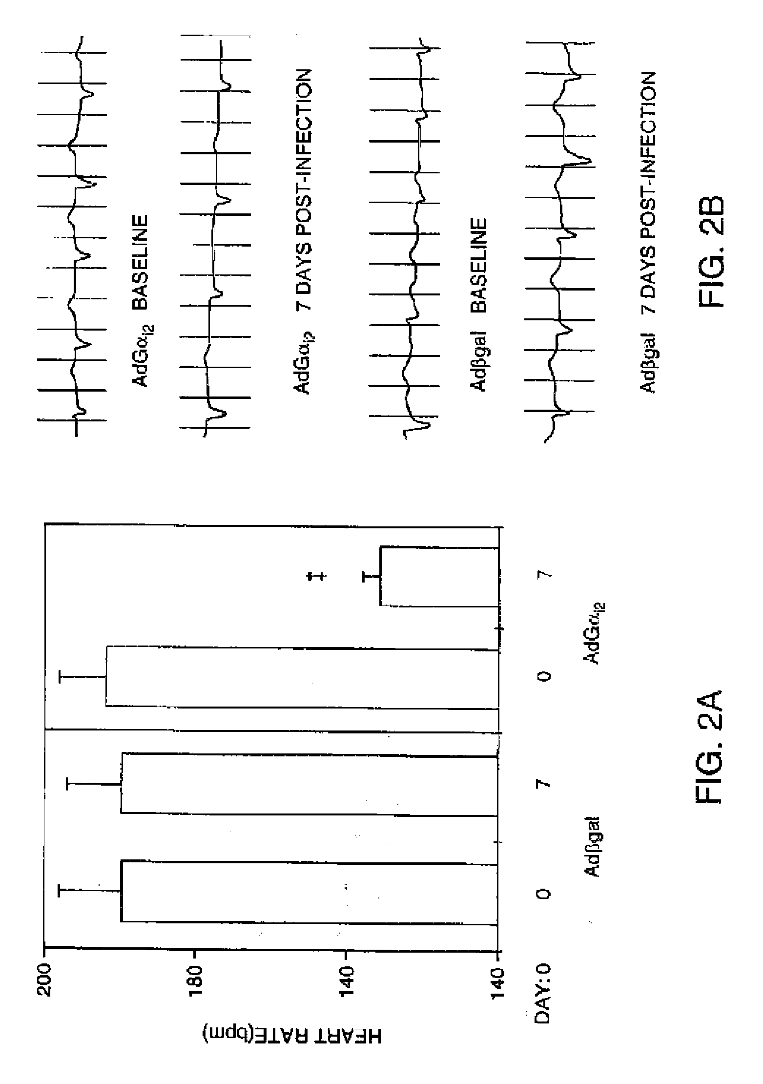 Cardiac arrhythmia treatment  methods and biological pacemaker