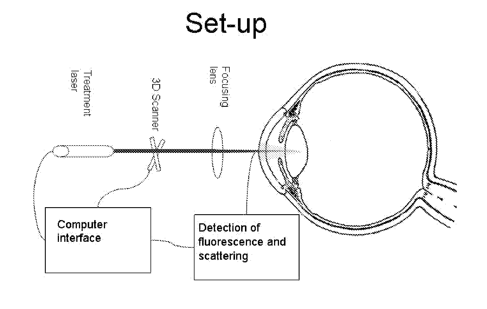 System and method for treatment of lens related disorders