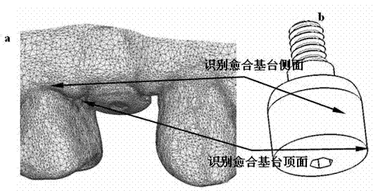 Implant denture individual abutment design method based on healing abutment dental model