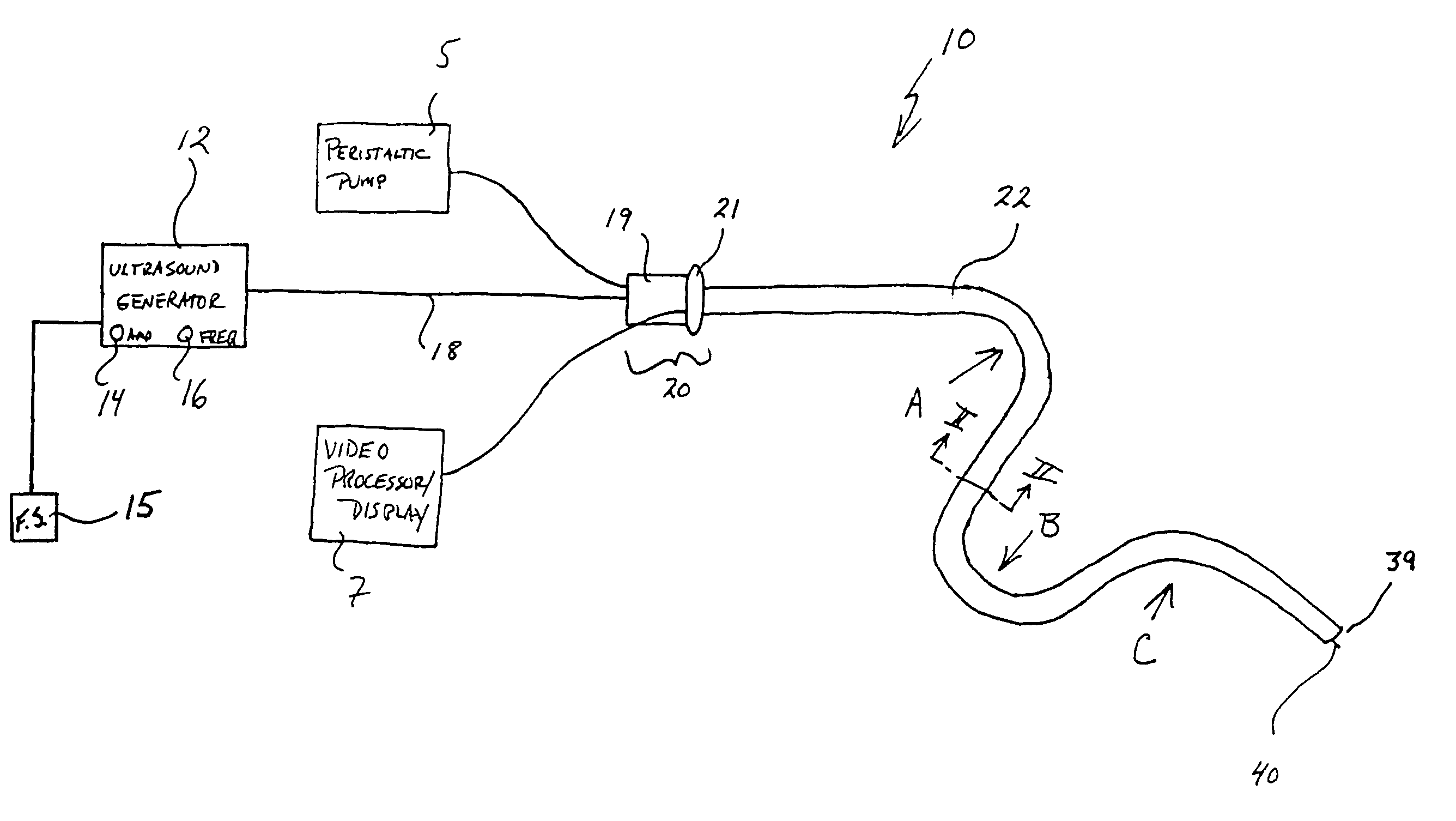 Flexible ultrasonic wire in an endoscope delivery system