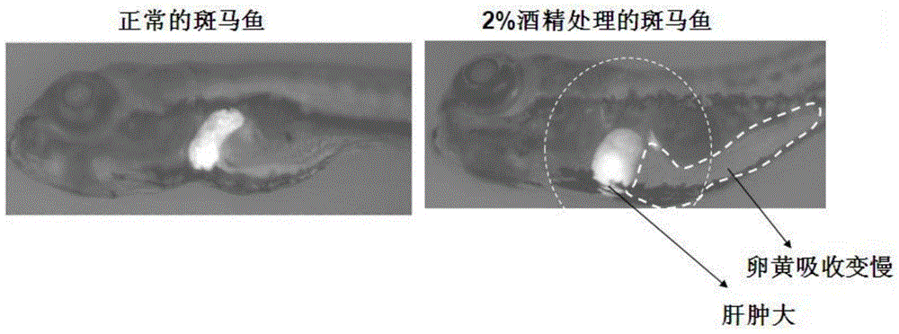 A detection model of zebrafish embryo alcoholic liver and its construction method and application