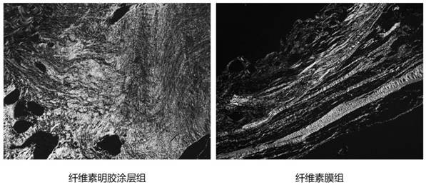 Cellulose gelatin coating-based rotator cuff patch and preparation method thereof