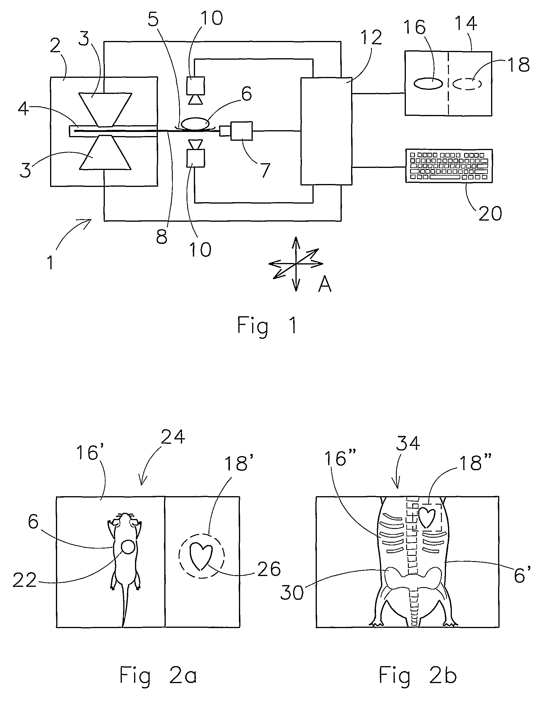 Gamma image detection device