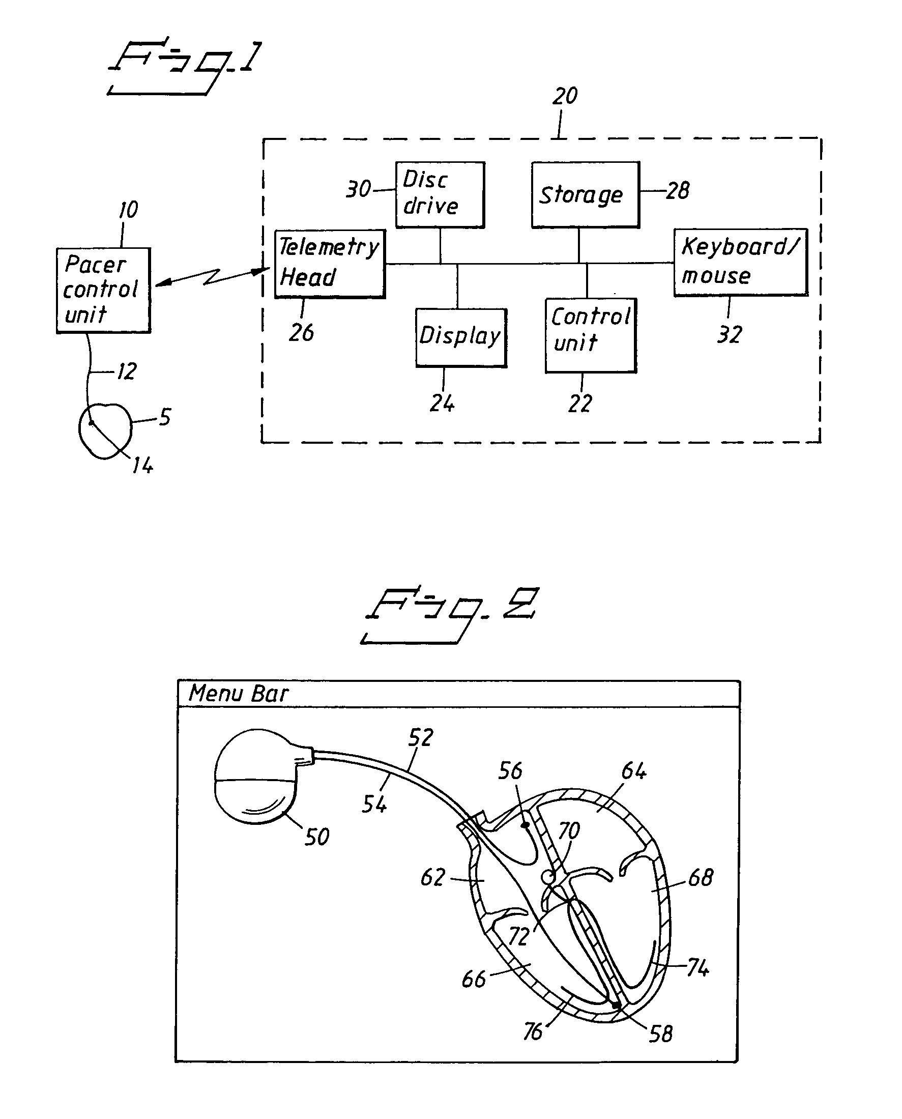 Programming system for medical devices