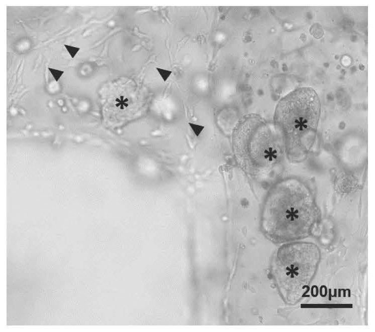 Artificial liver structure containing bile duct and liver tissue as well as preparation method and application of artificial liver structure