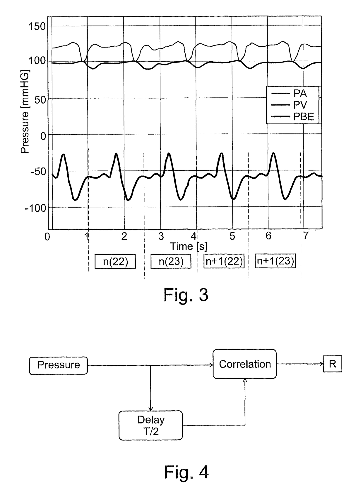 Fluid conveyance monitoring system in an extracorporeal blood treatment device