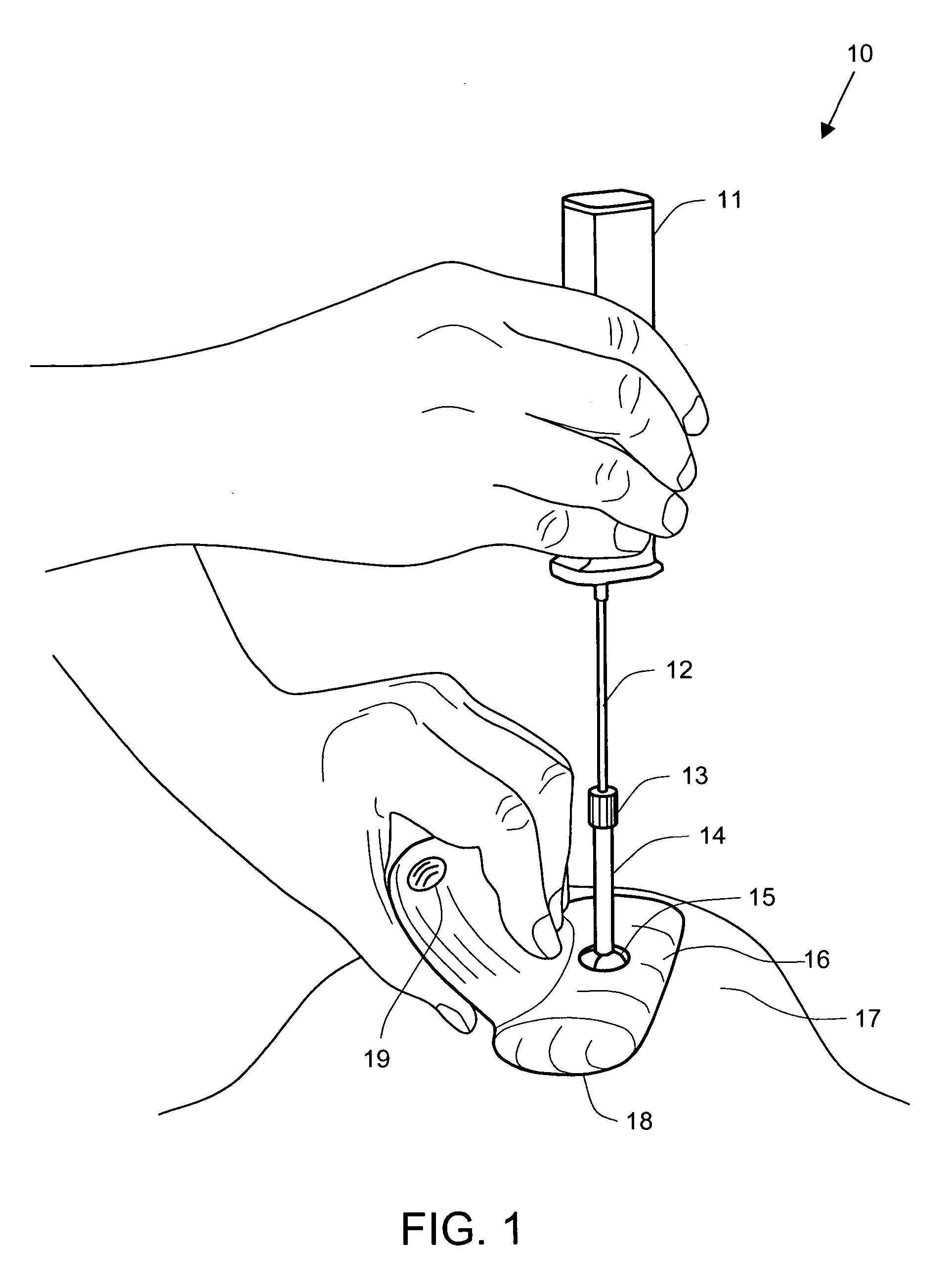 Device and method for biopsy guidance using a tactile breast imager