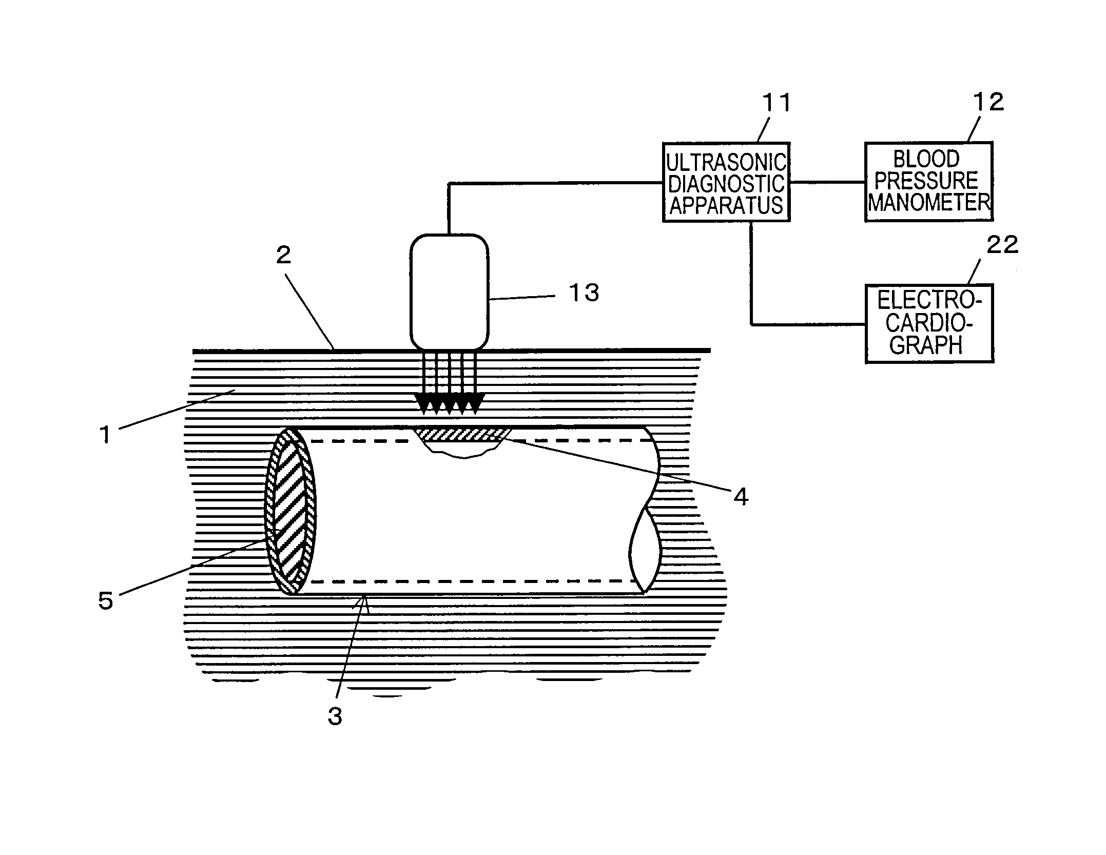 Ultrasonograph and Ultrasonograph Control Method