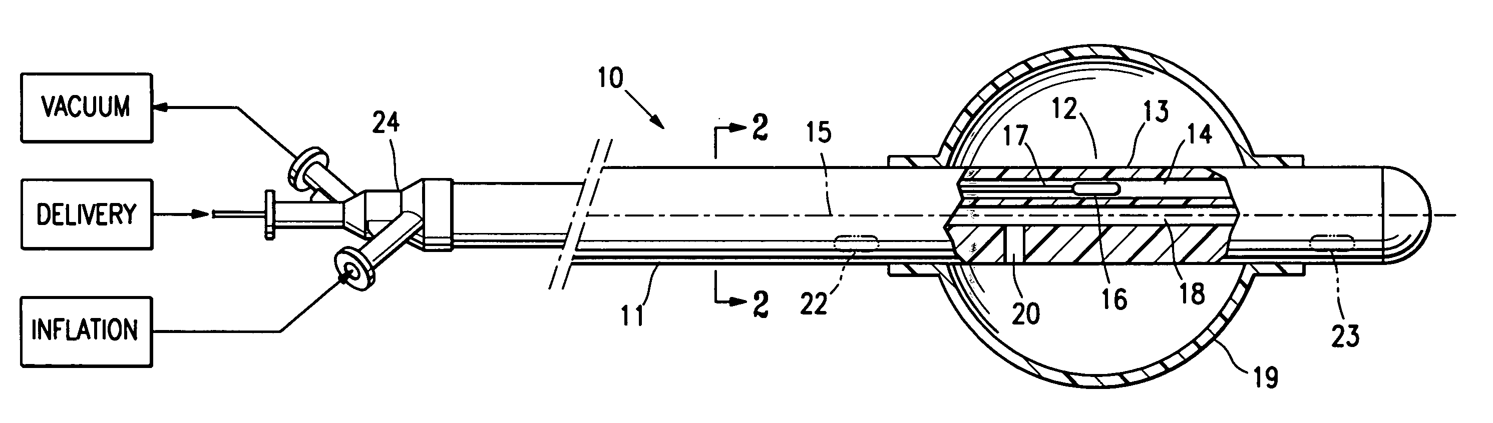 Asymmetrical irradiation of a body cavity