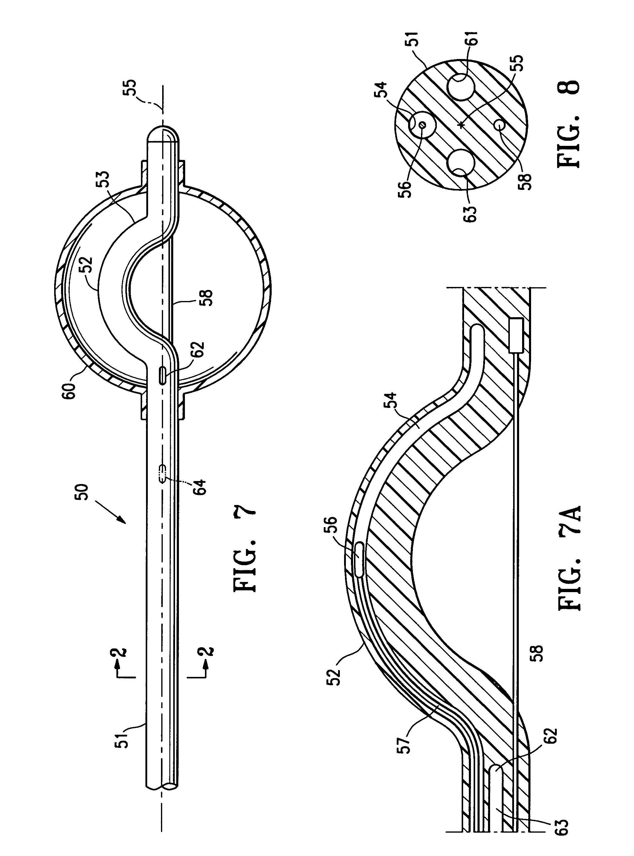 Asymmetrical irradiation of a body cavity