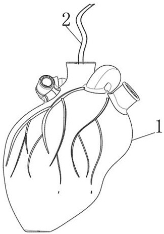 Anti-deformation medical tube capable of self-adapting to internal pressure environment of human body