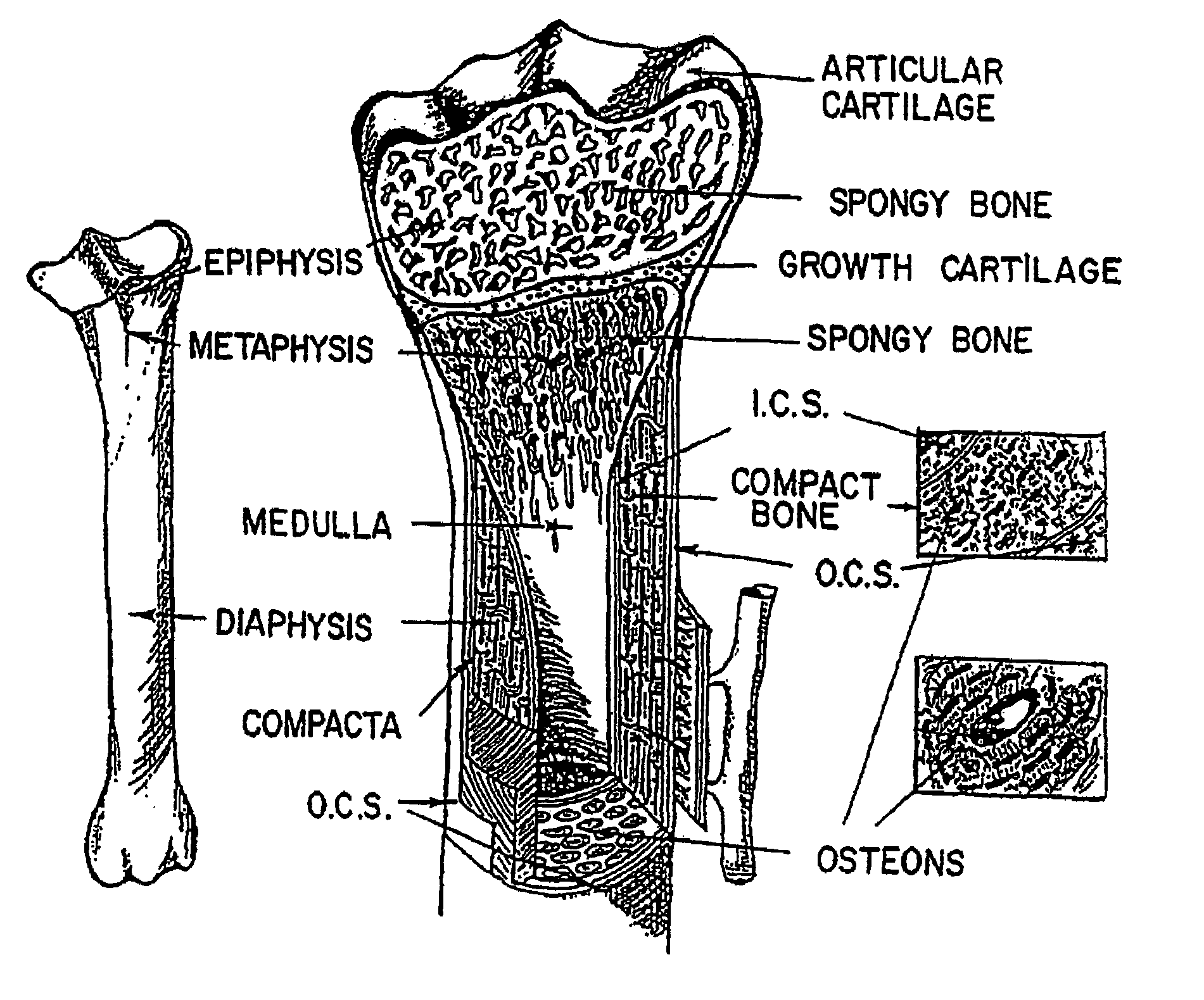 Method and system for modeling bone structure