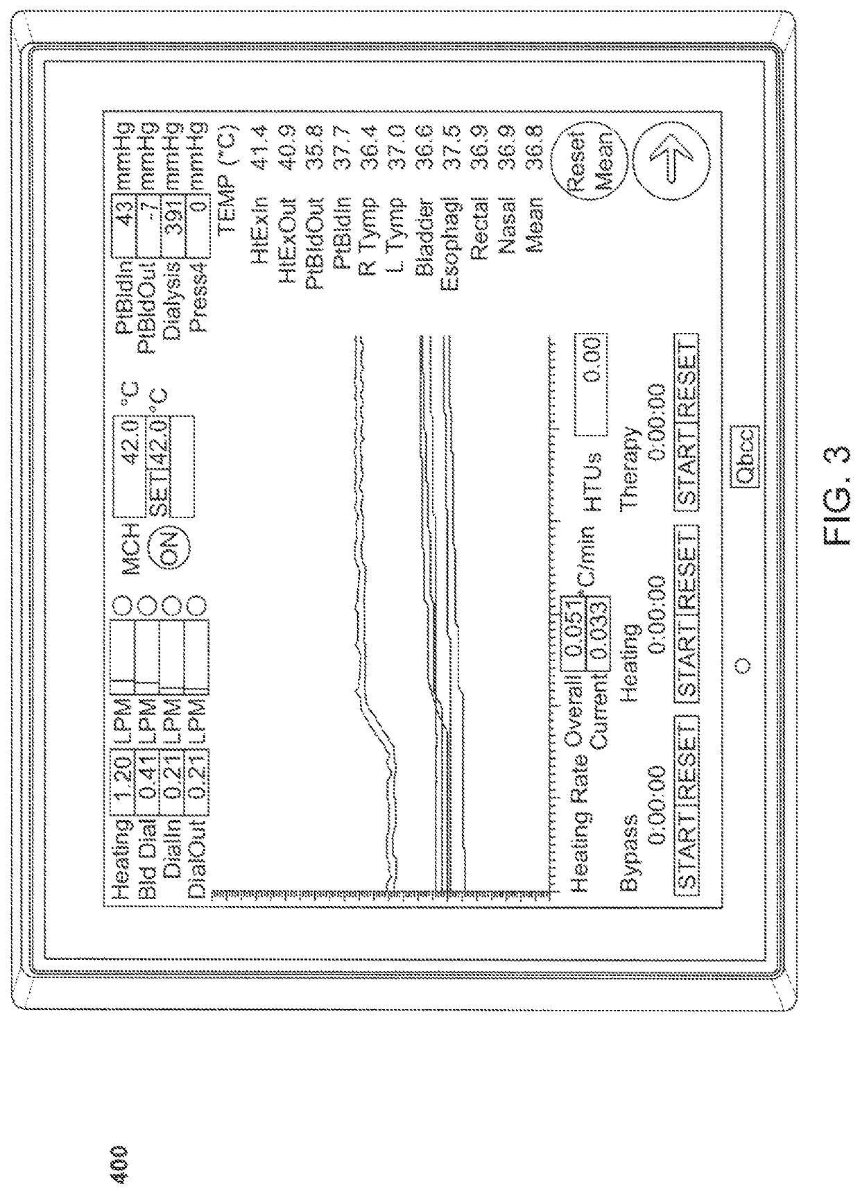 Method and system for controlled hyperthermia