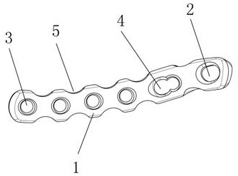 Anatomical sternoclavicular joint bone fracture plate and fixation system in sternoclavicular joint