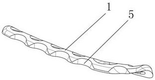 Anatomical sternoclavicular joint bone fracture plate and fixation system in sternoclavicular joint